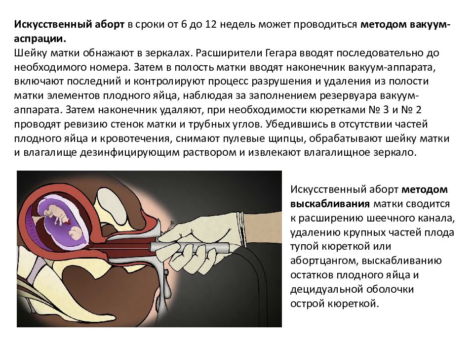 Малые гинекологические операции презентация