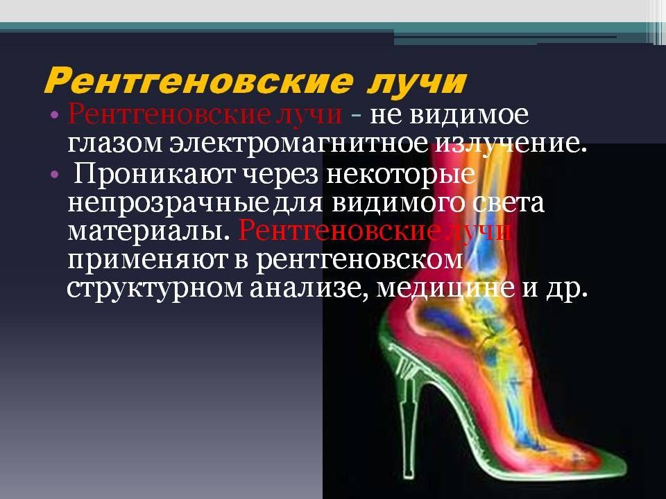 Презентация на тему рентген