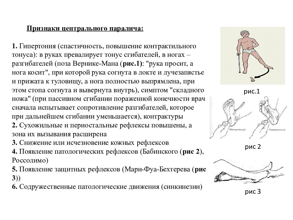 Гипертонус мышц бедра