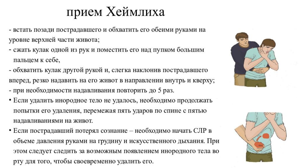 При полном нарушении. Прием Генри Геймлиха. Прием Хеймлиха. Приём Геймлиха обхватить. Приём Геймлиха встать позади.