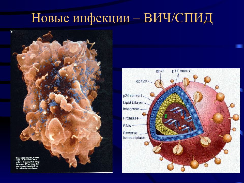 Вич патологическая анатомия презентация