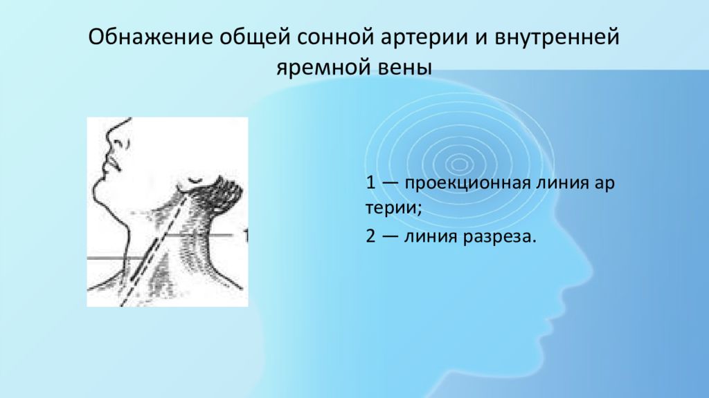 Оперативная хирургия головы и шеи презентация