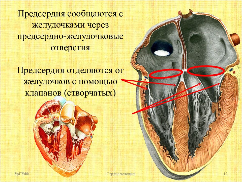 Отверстие в стенке правого предсердия