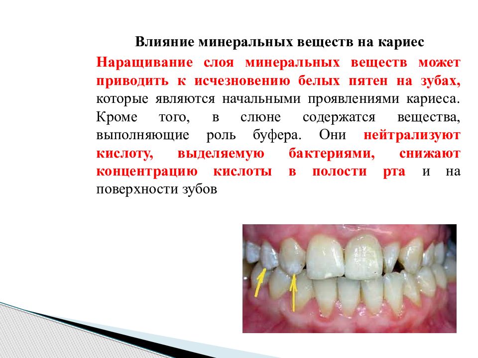 Зубы влияние. Презентация на тему начальный кариес. Твердость эмали. Факторы, влияющие на минерализацию твердых тканей зубов..