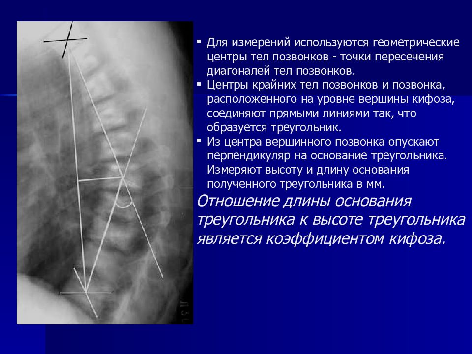 Укладки в рентгенологии в картинках и с описанием для начинающих