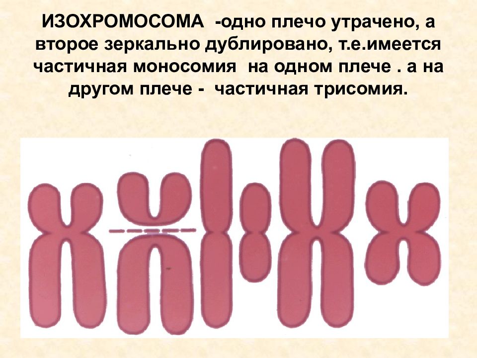 Имеется кольцевая хромосома. Изохромосомы. Изохромосома хромосома генетика. Дицентрическая хромосома болезнь. Образование изохромосом.