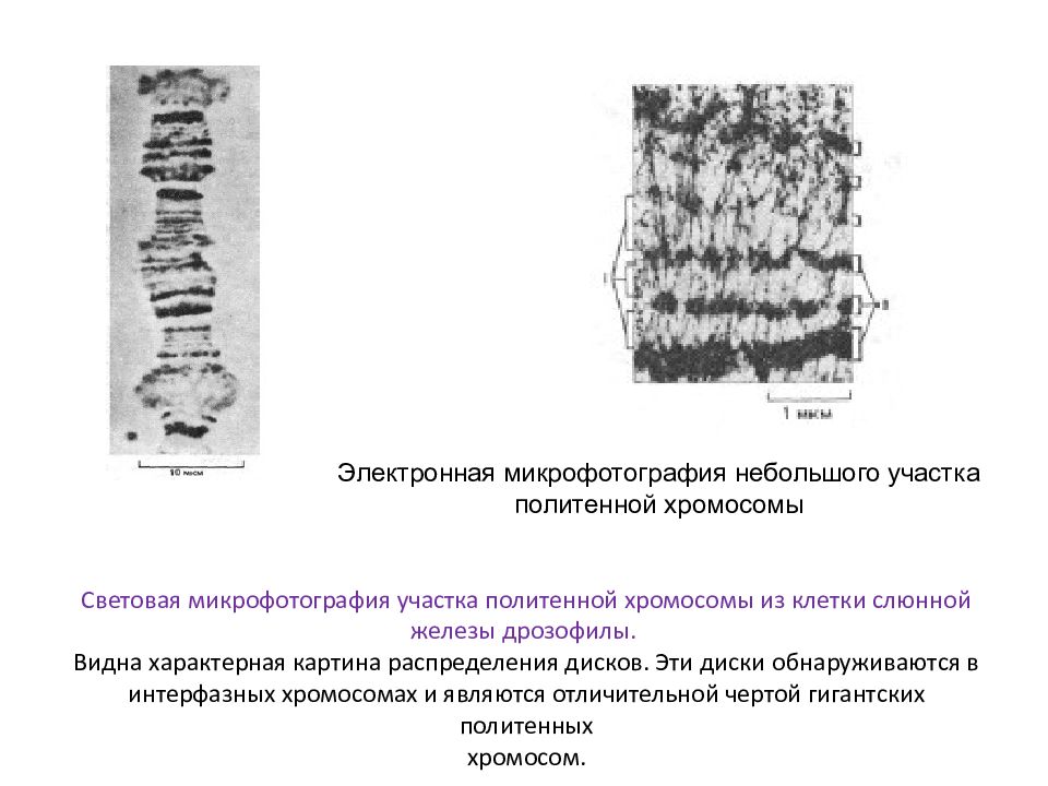 Интерфазные хромосомы. Политенные хромосомы. Политенные хромосомы дрозофилы. Диски политенных хромосом это. Хромосомы микрофотография.