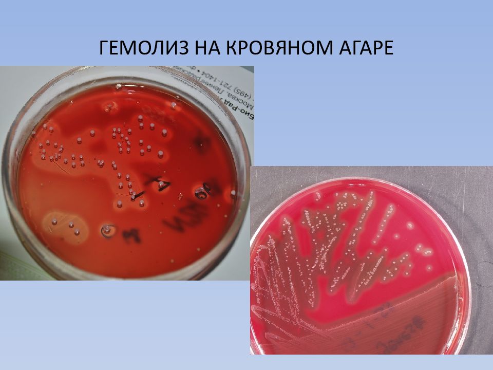 Гемолитическая кишечная. Альфа гемолиз на кровяном агаре. Гемолиз на кровяном агаре микробиология. Гамма гемолиз на кровяном агаре. Гамма-гемолитические стрептококки на кровяном агаре.