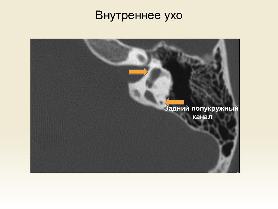 Дегисценция это Дегисценция это