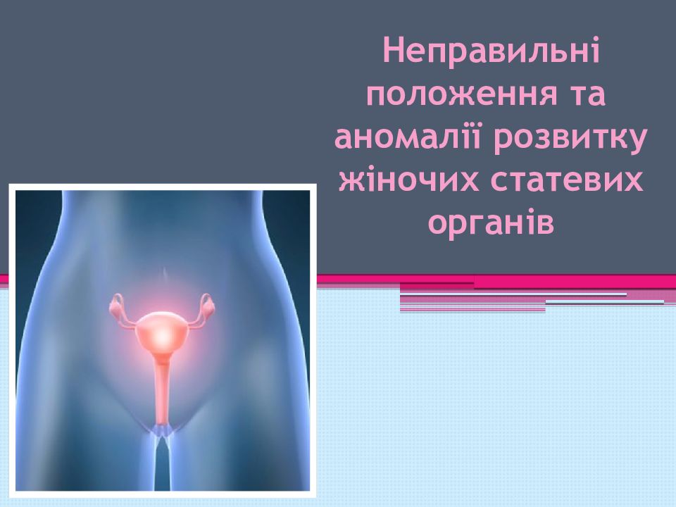 Неправильні по ложення та аномалії розвитку ж іночих статевих органів