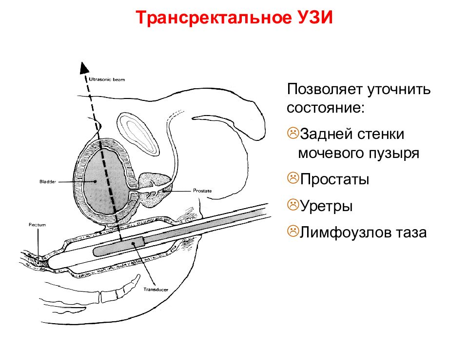 Как самому сделать массаж предстательной железы картинки