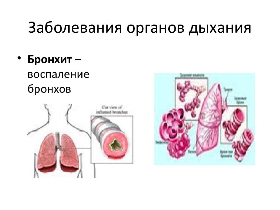 Средства влияющие на органы дыхания презентация