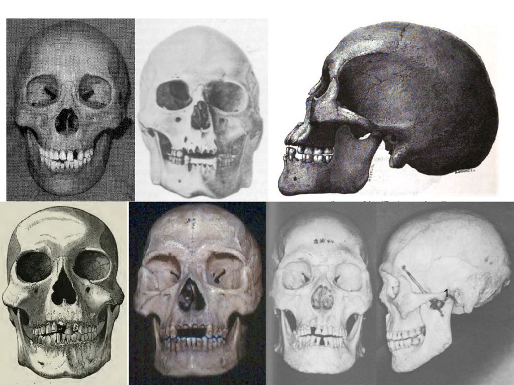 Черепа разных рас. Форма человеческого черепа. Череп монголоида и европейца. Черепа людей разных рас. Мадьяры реконструкция черепа.