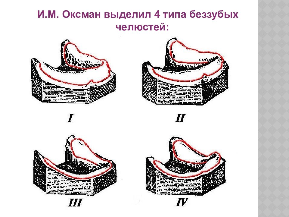 Классификация суппле картинки