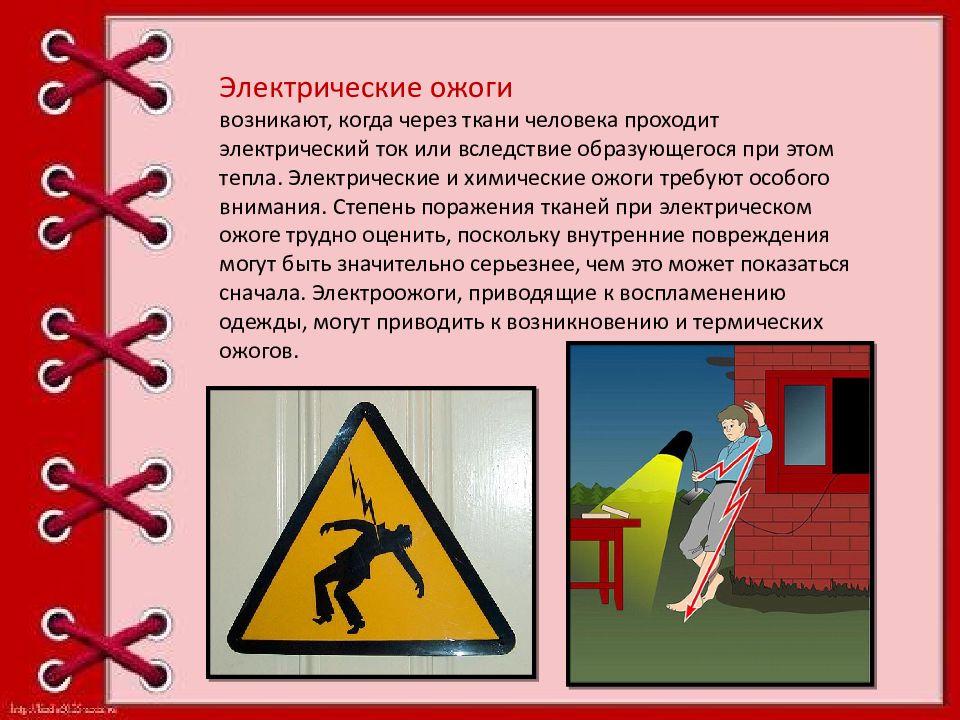 Помощь при ожоге током. Первая помощь при электрических ожогах. Электрический ожог определение. Электрический ожог первая помощь.