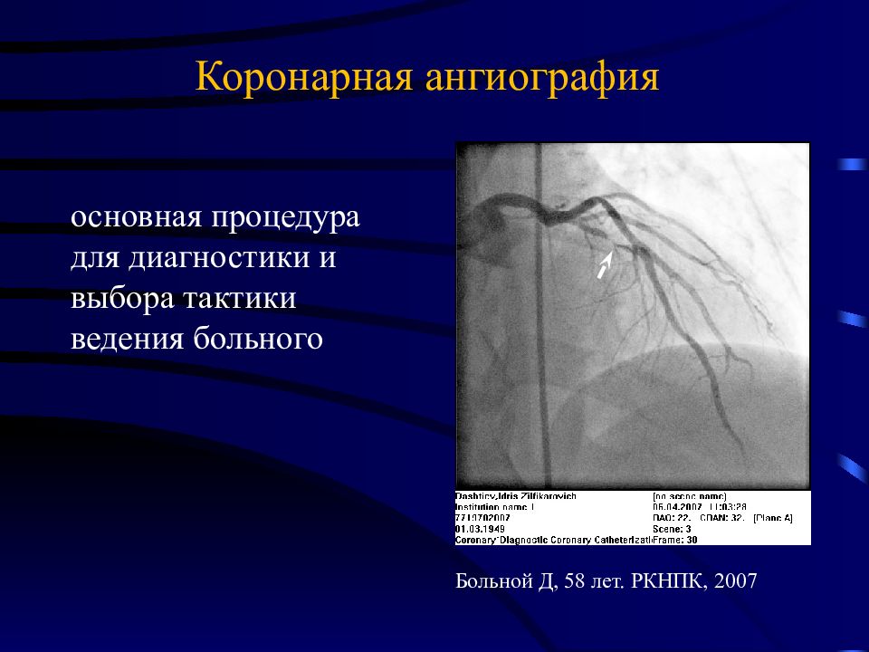 Диагноз больница. Ангиография презентация. Коронарная ангиография заключение. Диагностика коронарная ангиография. Коронарная ангиография клинические рекомендации.