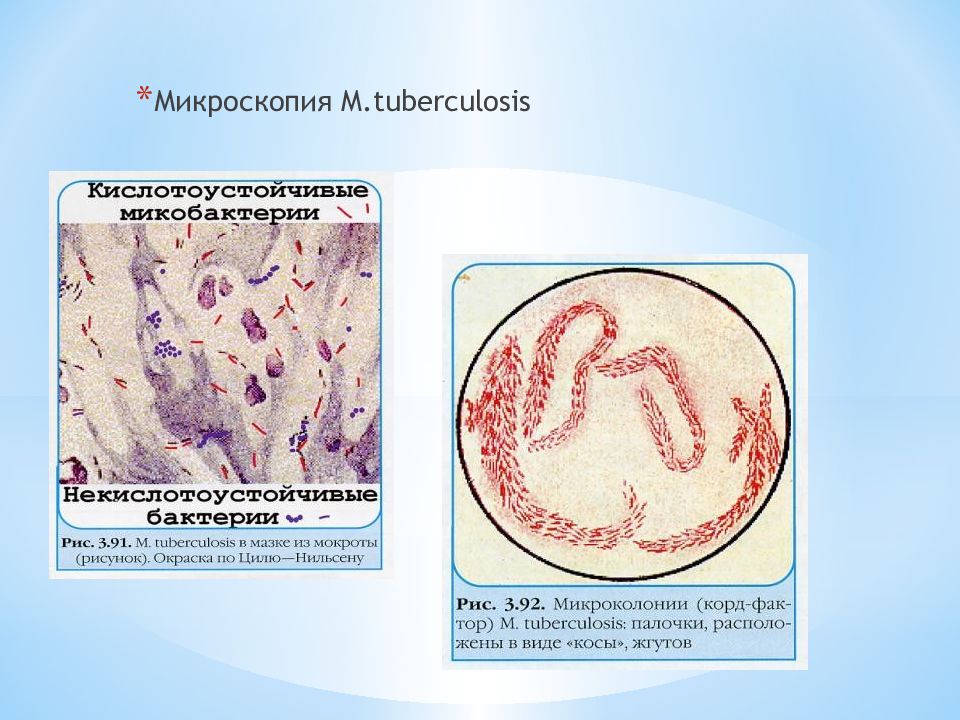 Кислотоустойчивые микобактерии. Возбудитель туберкулеза рисунок. Микобактерия туберкулеза картинка. Микобактерия туберкулеза рисунок.
