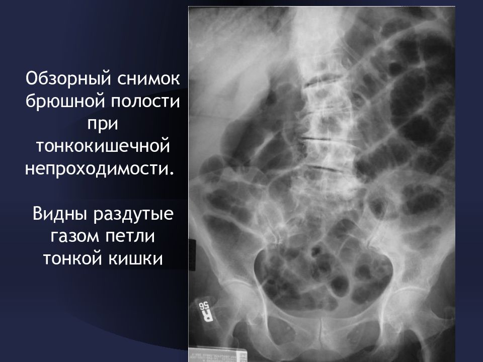 Лучевая диагностика в оториноларингологии и офтальмологии презентация