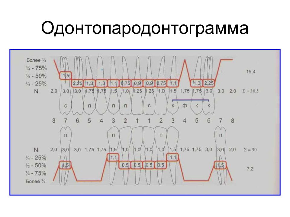 Пародонтограмма. Одонтопародонтограмма Курляндского. Пародонтограмма в.ю. Курляндского. Одонтопародонтограмма Курляндского анализ. Заполнение одонтопародонтограммы.