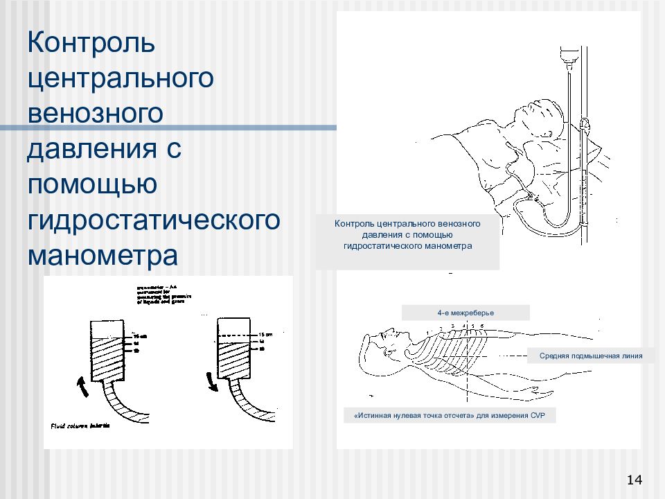 Центральное венозное. Методика измерения ЦВД алгоритм. Измерение ЦВД аппаратом Вальдмана. Измерение ЦВД норма. Контроль ЦВД методика измерения.