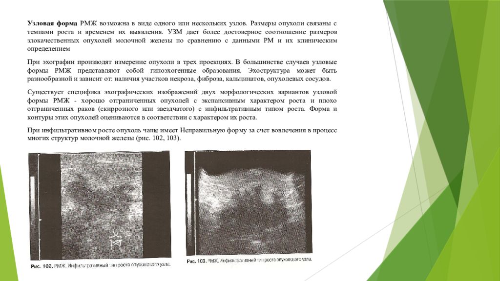 Ультразвуковая картина доброкачественных опухолей молочной железы тесты нмо ответы