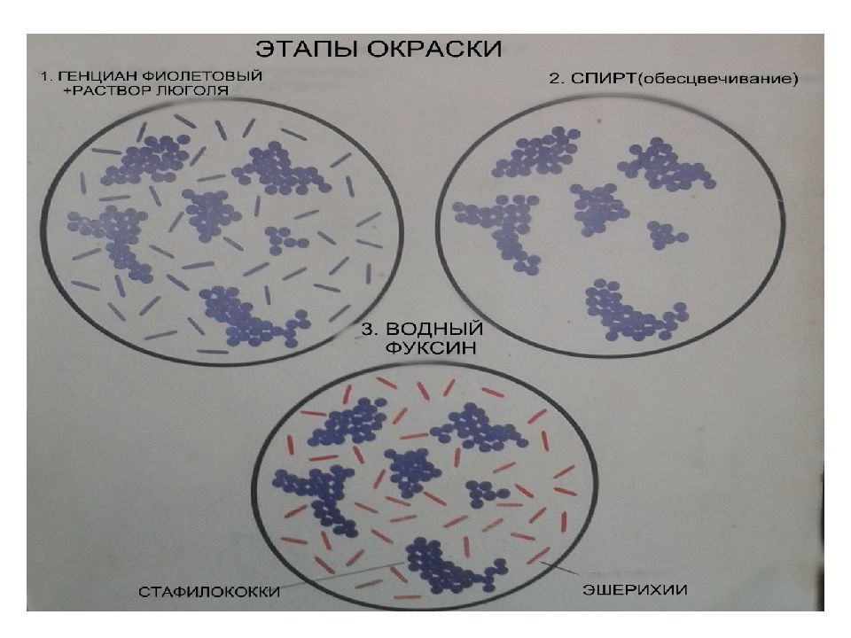 Рисунок мазка стафилококка