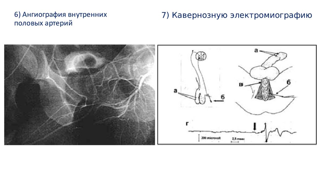 ВПР внутренних половых органов. Внутренняя половая артерия. Бульбарные артерии полового члена.