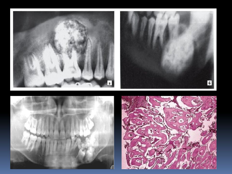 Опухоли и опухолеподобные образования. статистика, классификация опухолей