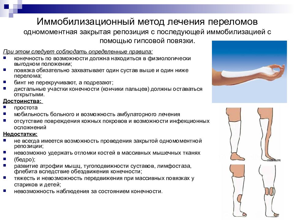 Современные методы лечения переломов презентация