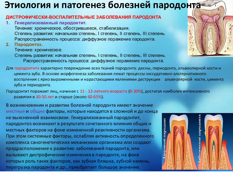 Особенности строения пародонта у детей презентация