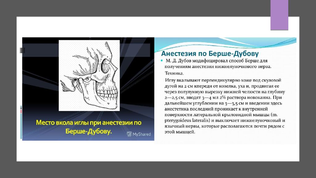 Анестезия по берше. Стволовая анестезия по Берше-дубову-Уварову. Стволовая анестезия по Берше-дубову-Уварову, Вайсблату.. Внеротовая анестезия по Берше дубову. Обезболивание по Берше дубову.