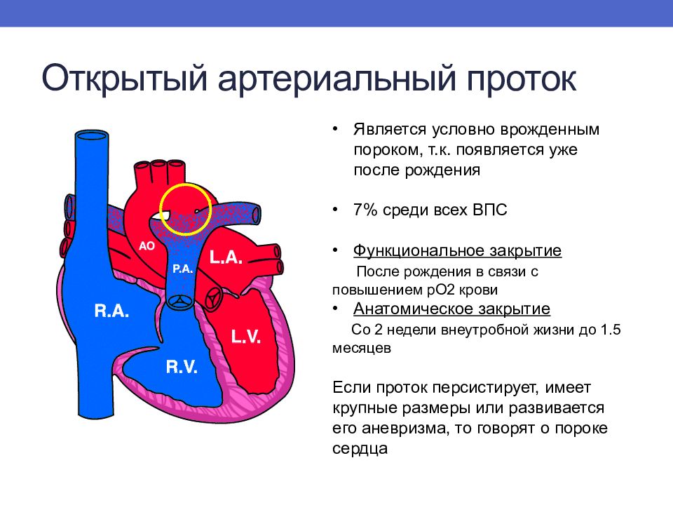 Пороки сердца схема