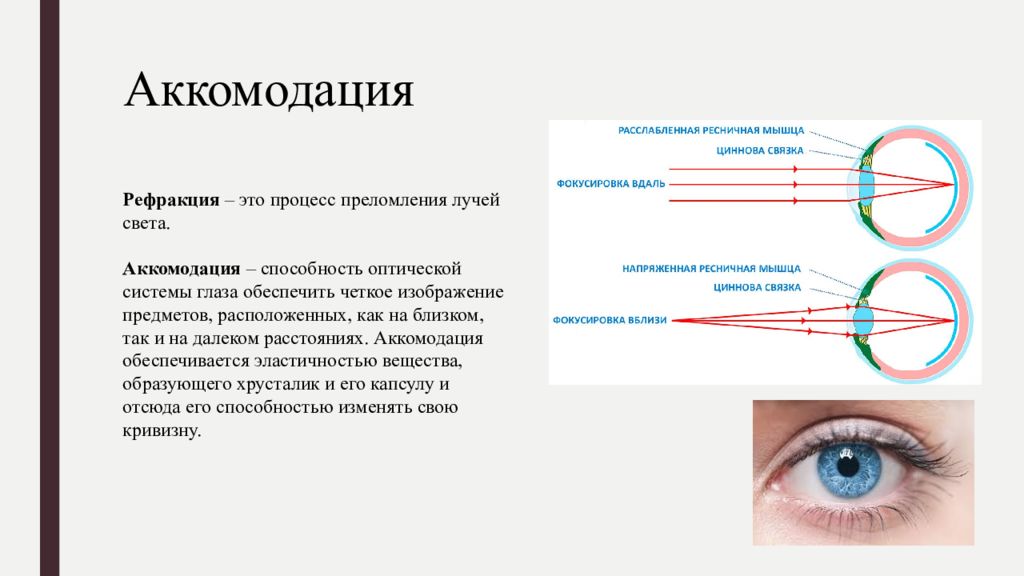 В здоровом глазу в результате преломления изображение формируется на