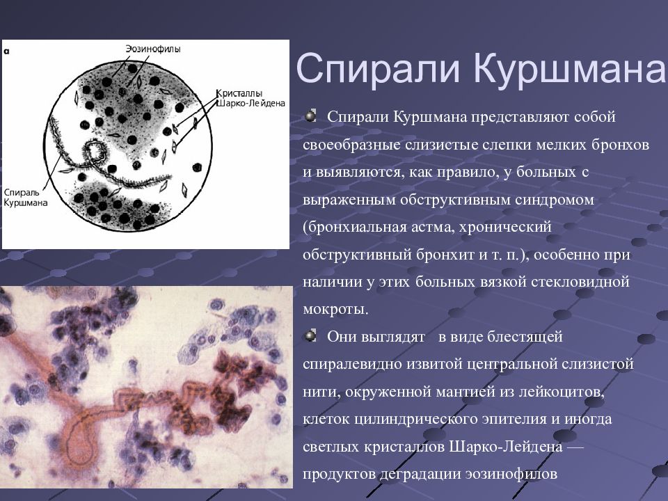 Микроскопия мокроты в картинках с описанием