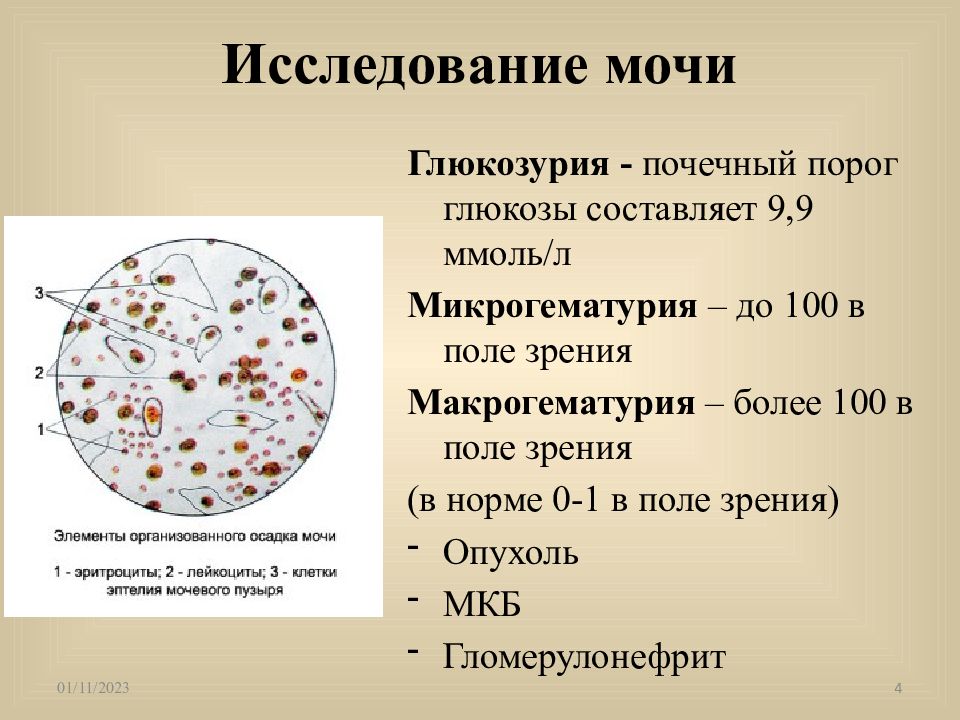 Биология порог. Порог Глюкозы в моче. Микрогематурия мкб. Почечный порог проницаемости для Глюкозы. Болезни почек презентация.