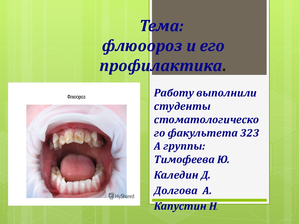 Тема Флюороз Тема: флюоороз и его профилактика.