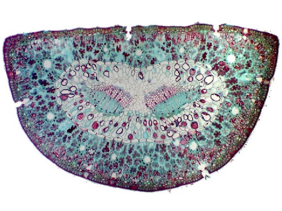 Анатомия растений ботаника. Паренхима мезофилл. Губчатый мезофилл микроскоп. Мезофилл под микроскопом. Клетки мезофилла цвет.