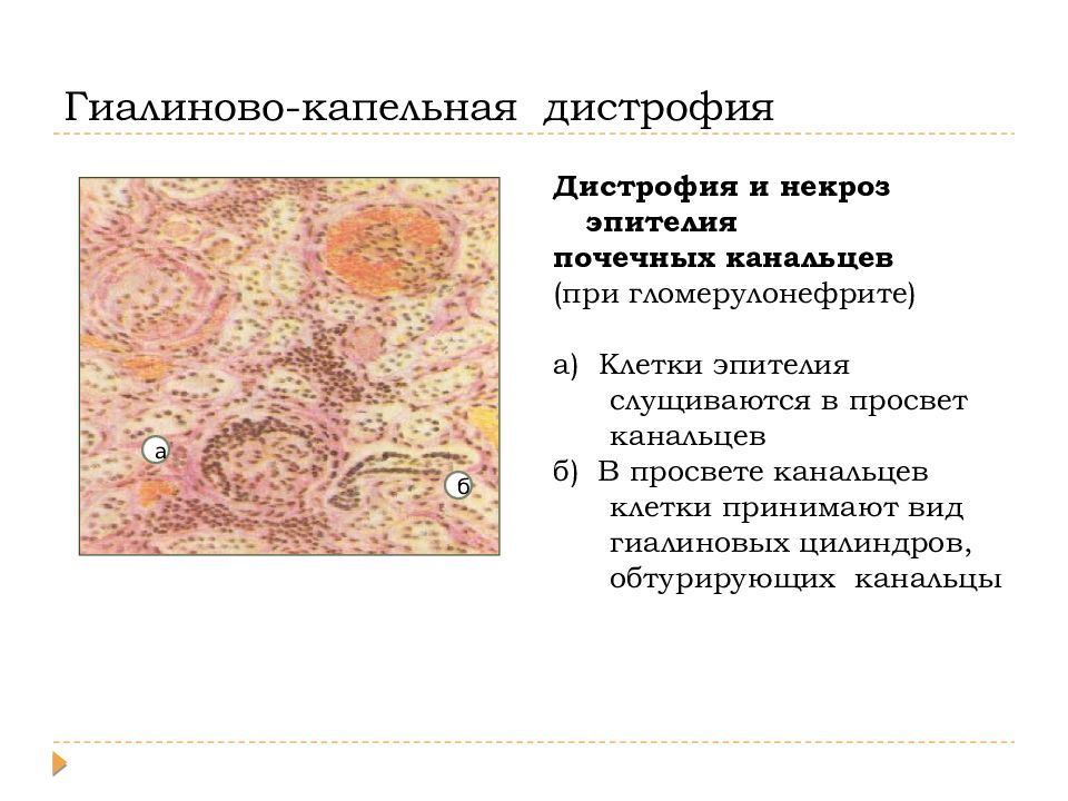 Повреждения дистрофии презентация