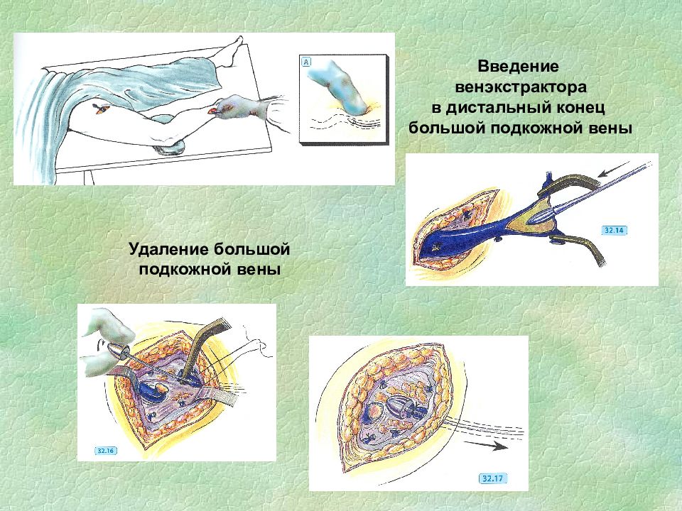 Какой их кровеносных сосудов изображенных на рисунке играет основную роль в обменных процессах