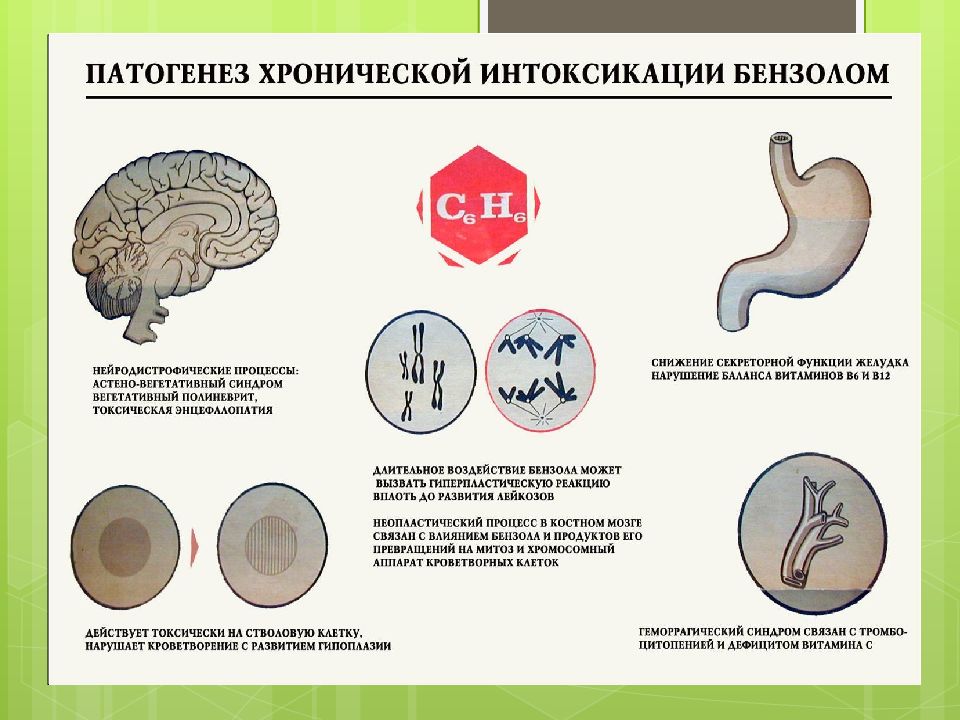 Острое отравление картинки