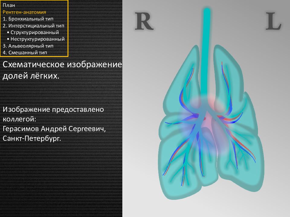 Анатомия рентген. Рентгенологическая анатомия легких. Рентген легких анатомия. Лёгкие анатомия рентген. Анатомия бронхиальное дерево на рентгене.