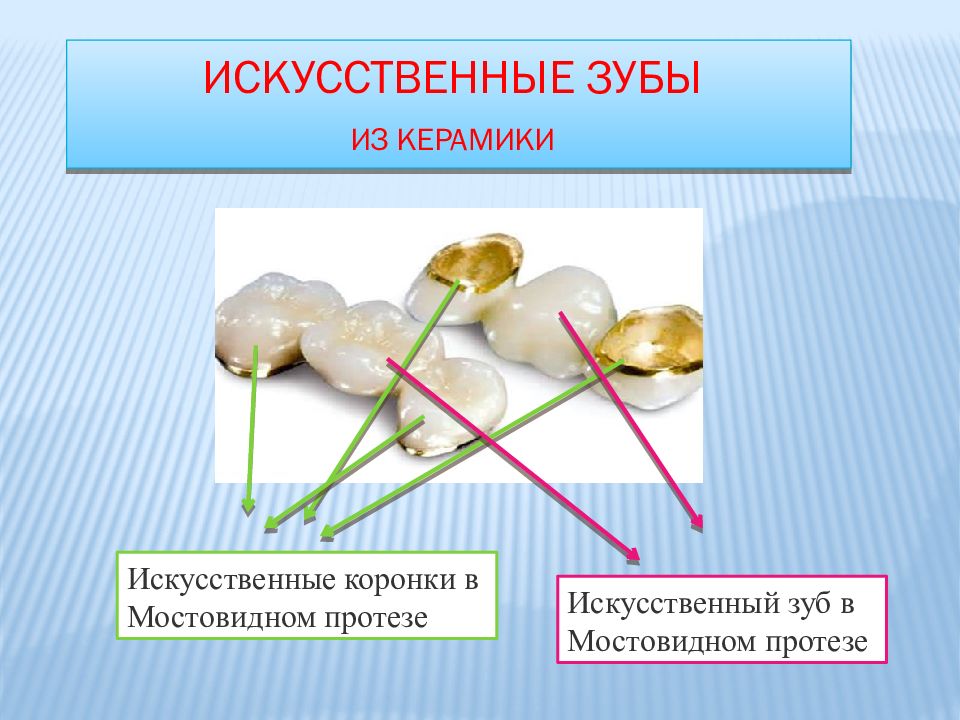 Стоматологическая керамика презентация