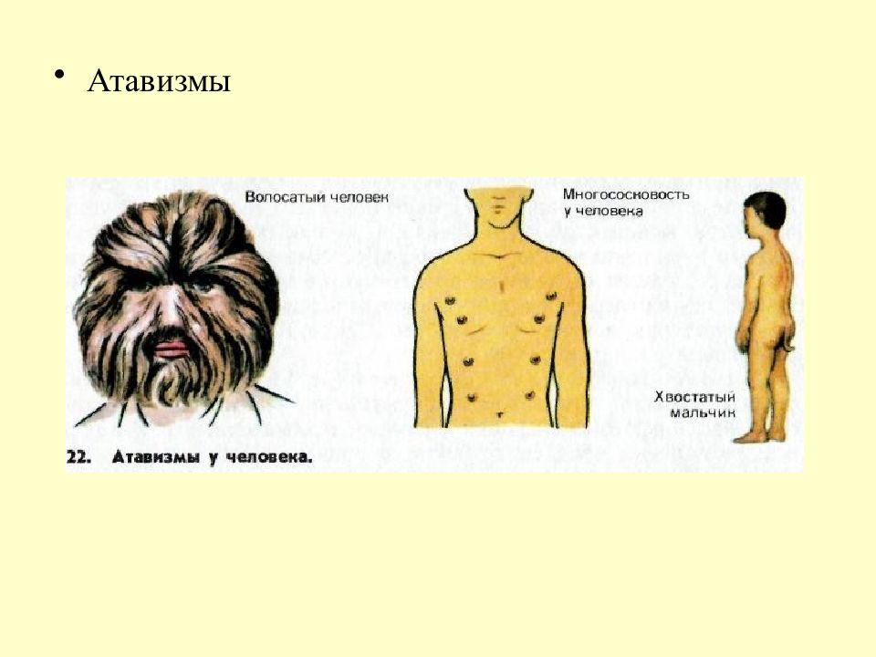 Атавизмам относят. Атавизм и рудимент хвост. Атавизмом у человека является.