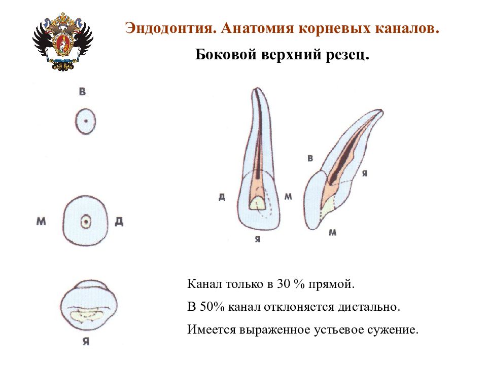 Верхний 5 зуб канал