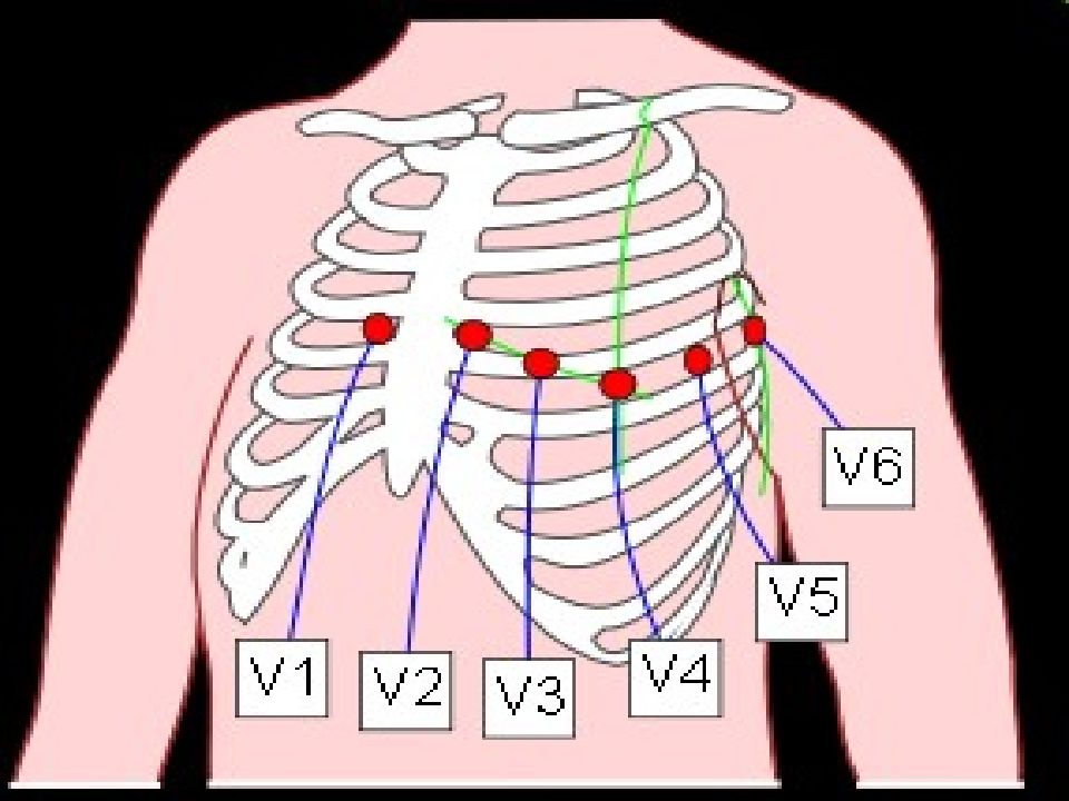 Схема кардиограммы как делать