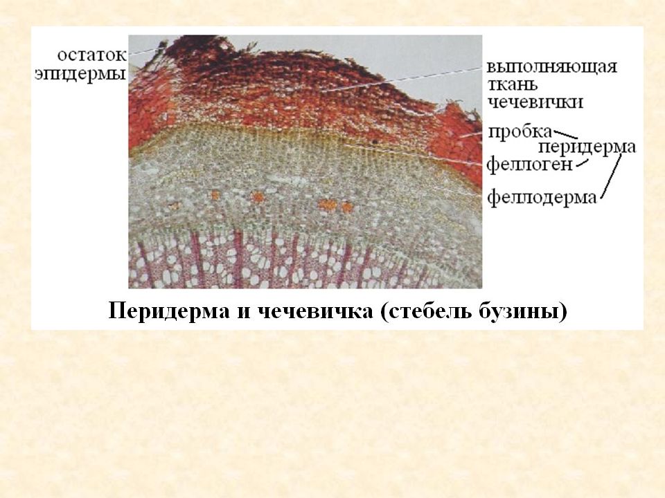 Строение пробки. Перидерма стебля бузины под микроскопом. Строение перидермы и чечевички бузины. Строение перидермы бузины. Строение перидермы стебля бузины.