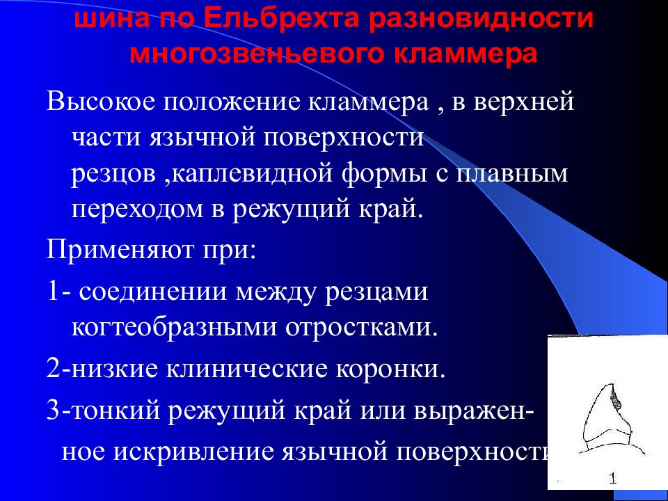 Высокое положение. Шина Степанова клинико лабораторные этапы. Требования к отростку кламмера. Высокое положение (супрааномалия).