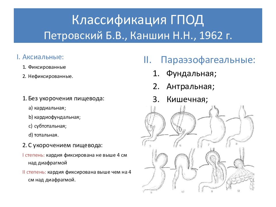 Эндоскопическая картина при грыжах пищеводного отверстия диафрагмы характеризуется