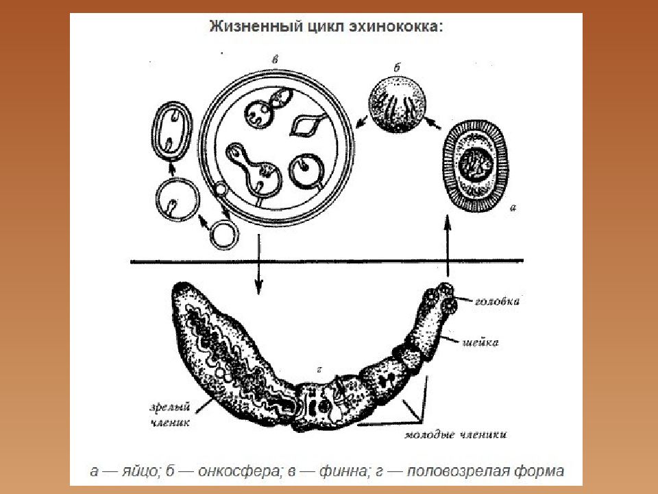 Эхинококк аскарида. Ленточный червь эхинококк. Финна эхинококка строение. Эхинококк строение рисунок.