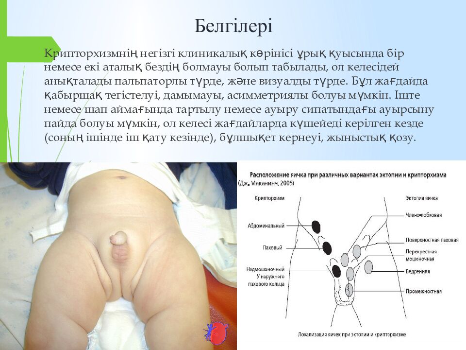 Белгілері